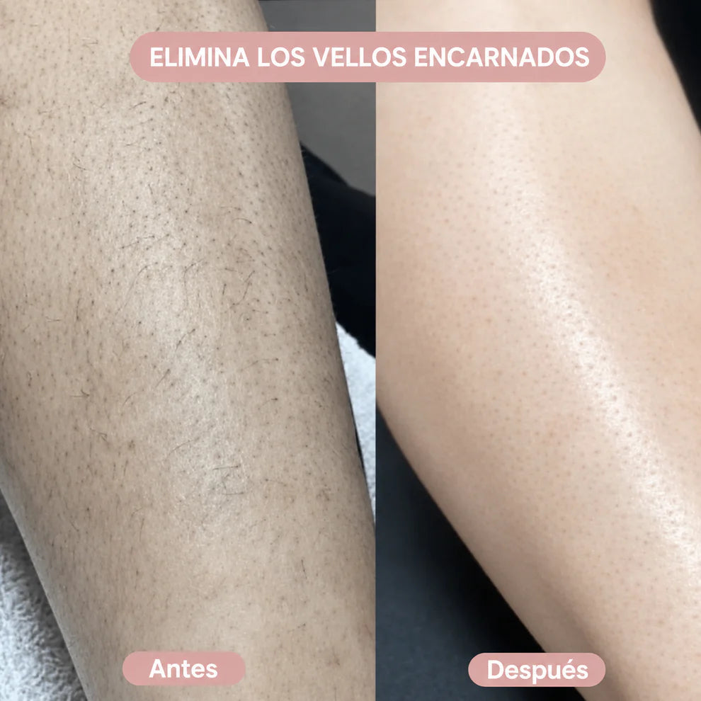 Depiladora Eléctrica Femenina 2 en 1 | Bikini y Cuerpo