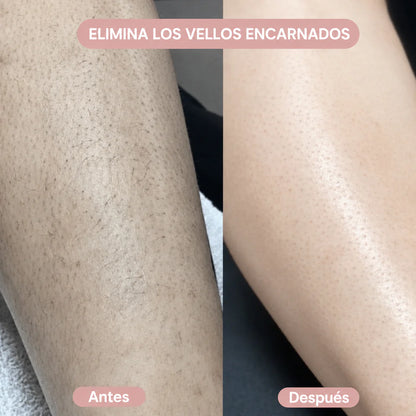 Depiladora Eléctrica Femenina 2 en 1 | Bikini y Cuerpo