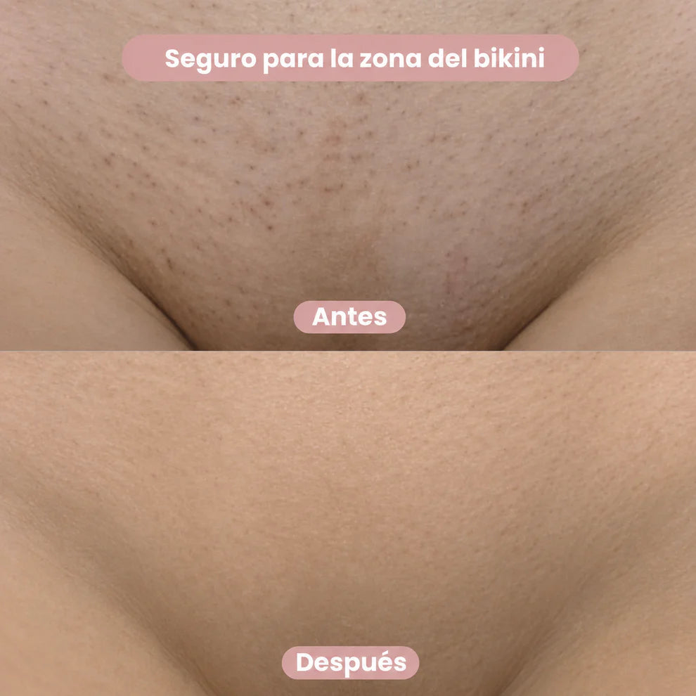 Depiladora Eléctrica Femenina 2 en 1 | Bikini y Cuerpo